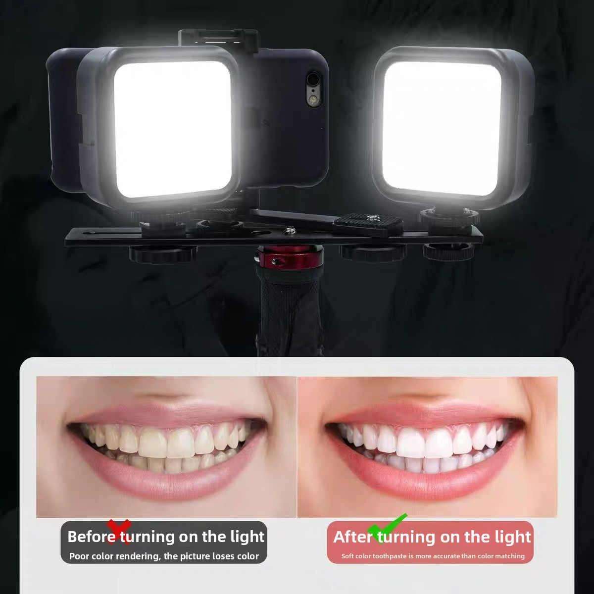 Photography Basics - Bluetooth Özellikli Diş Fotoğrafçılığı Işığı, Oral